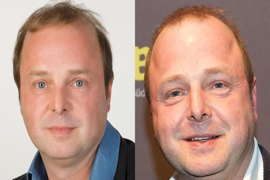 Wolfgang Feindt Todesursache